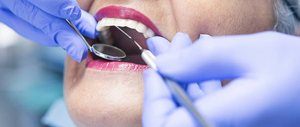 Best Emergency Dental Care for Broken or Chipped Teeth in Cliffwood Beach, NJ